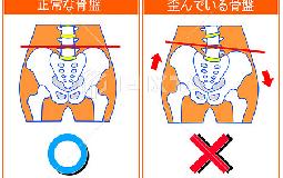 産後　骨盤矯正　歪み